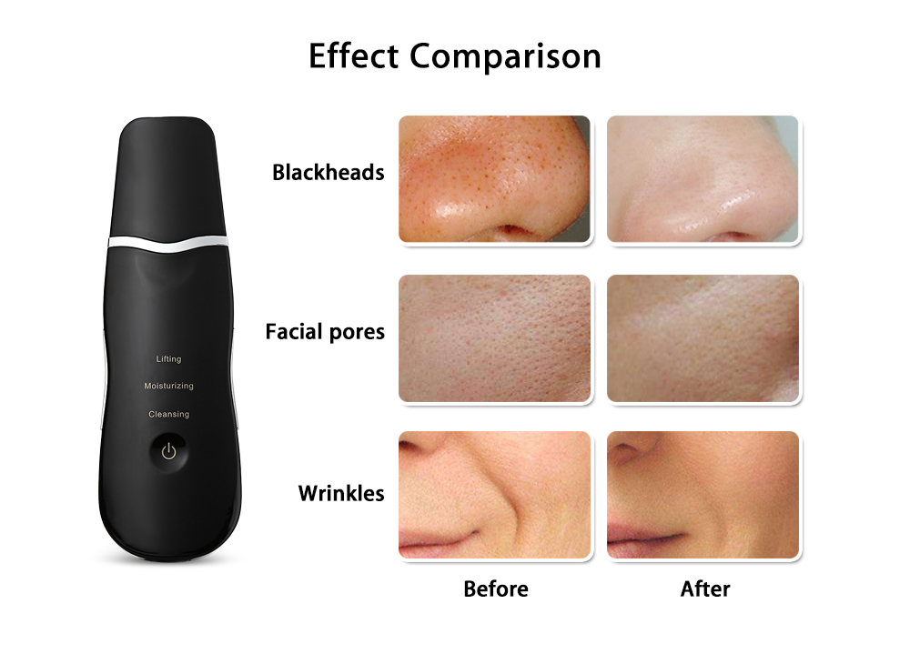 Ultrasonic Rechargeable Face Skin Scrubber Facial Cleaning Blackhead Removal Cleaner 